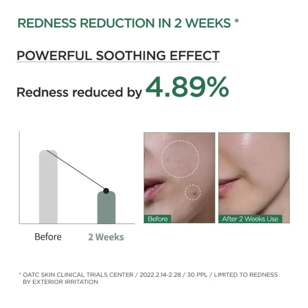 Anua Heartleaf 80% Moisture Soothing Ampoule