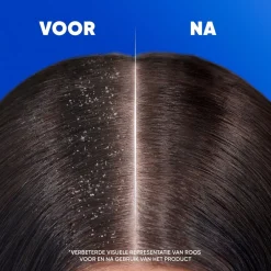 Head & Shoulders Apple Fresh Antiroosshampoo