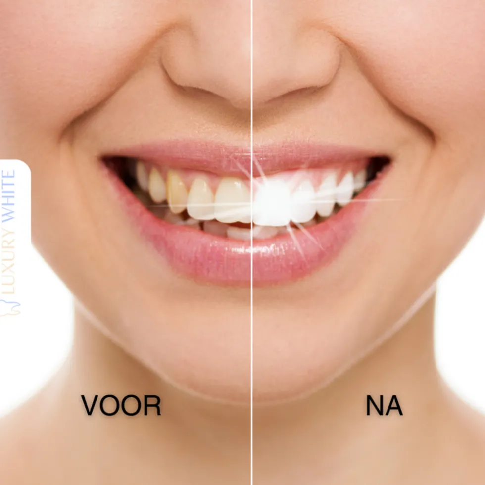 Luxury White Whitening Pen